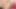 Speculum masturbation
