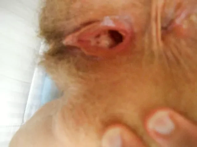 spreading holes for cum