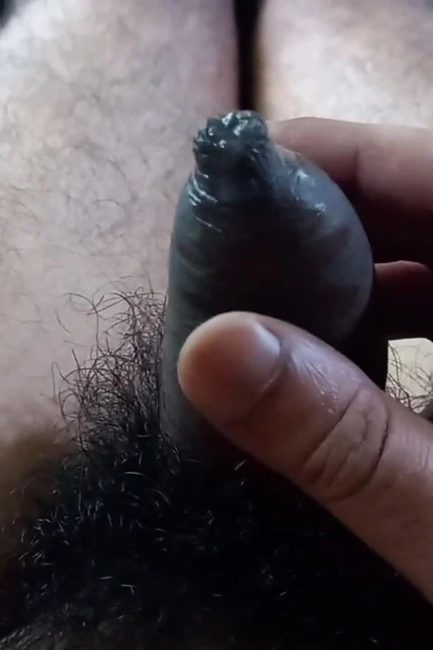 Tng chamari phimosis lnd klojap viry nikalne tak tapakta prikam