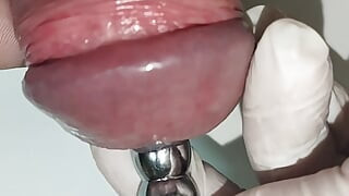 Dilatator