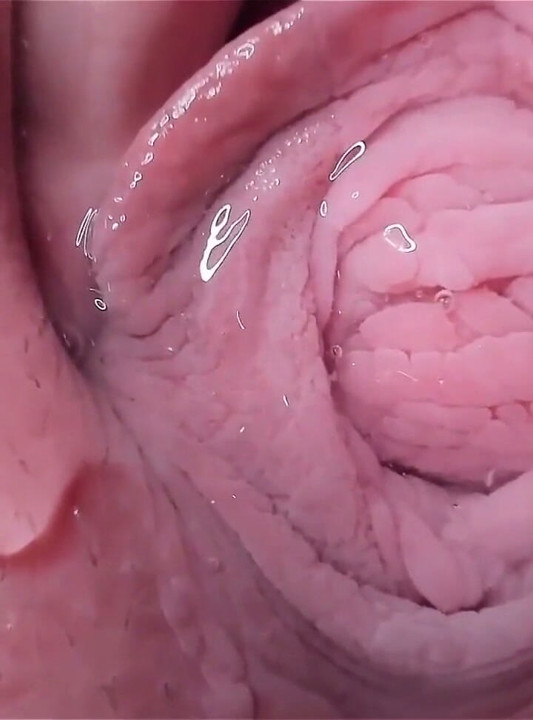 See Inside Me