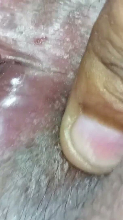 Butthole Close Up Show | Clip 2
