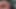 Uncut Tight Phimosis Cock Precum Tease for Foreskin Lovers with cumshot