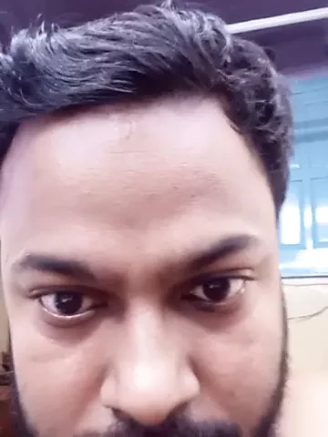 Imi