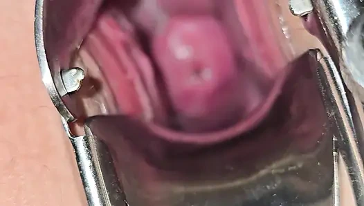 Милфа осматривает ее киску и вводит гинекологическое зеркало, чтобы увидеть внутри