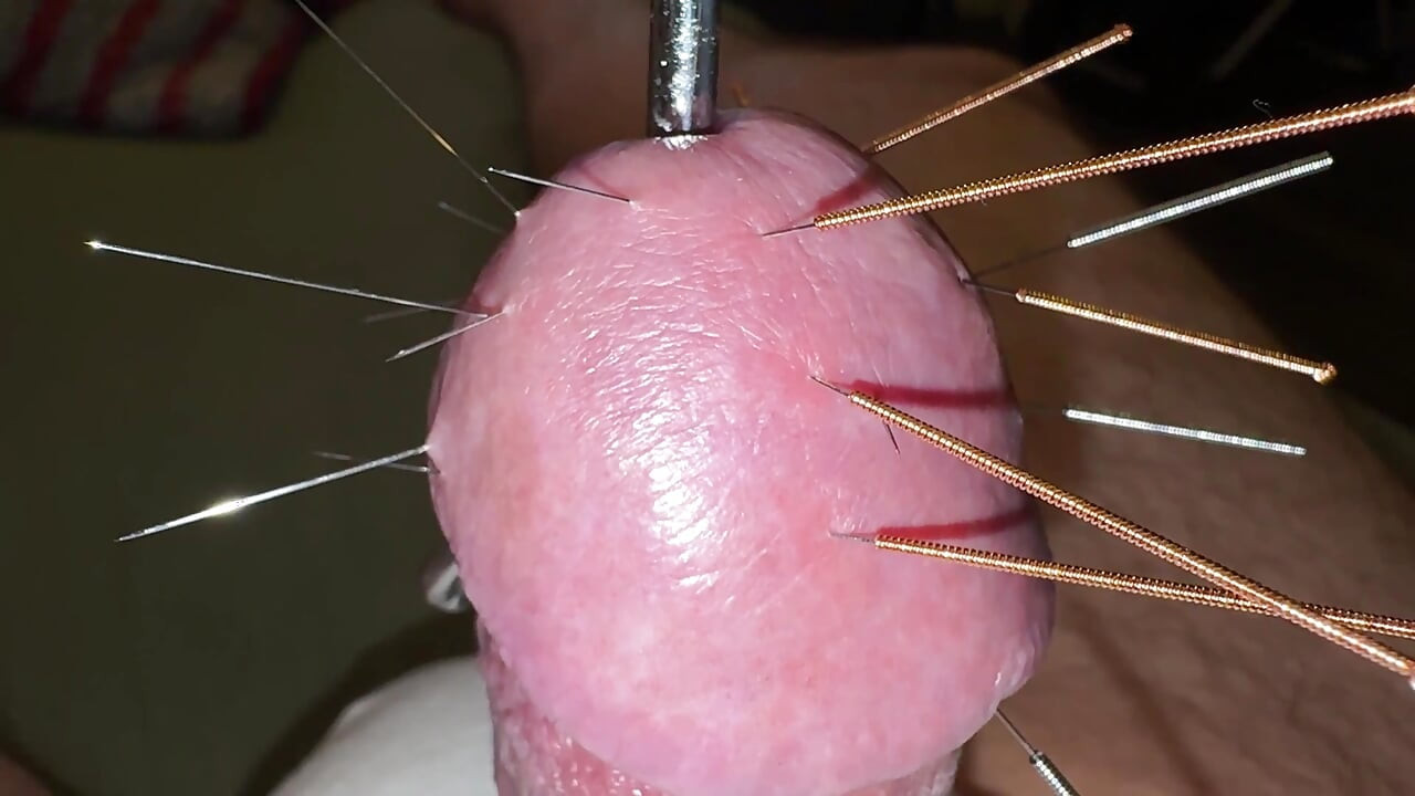 Acupuncture - Orgasm!
