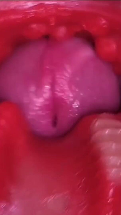 Cumfeti Dripping Creampie Compilation- widok endoskopowy | Clip 2