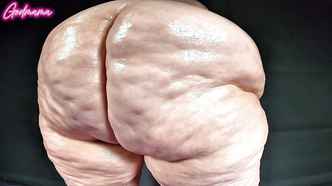 Mông siêu cellulite