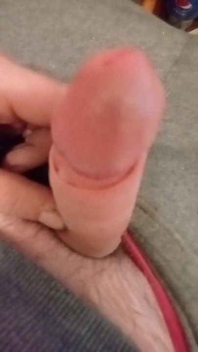 Dick