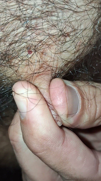 Hairy nipples in the foreground