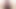 お尻のセルライト