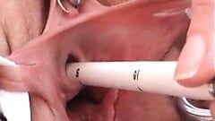 Le col de l'utérus et le trou de pipi baisent avec des objets et se masturbent dans l'urètre