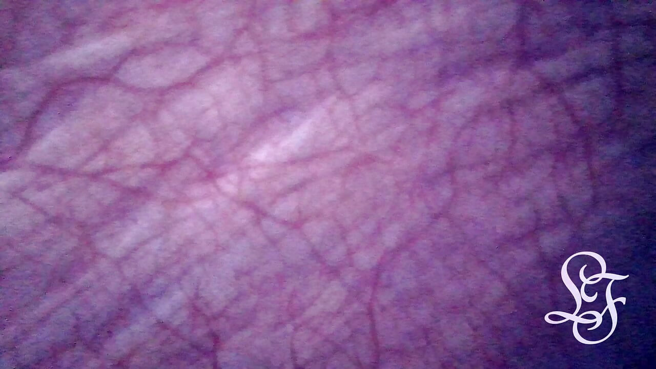 Assistindo minha ventre cheia de saliências para fora da minha barriga