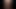 Sikimin gözlerinin önünde büyümesini izle