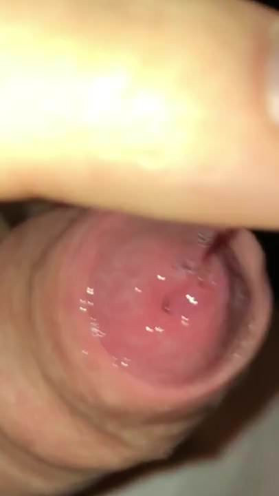 mhd