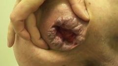 prolapse Large anal fist insertion extreme stretch weird