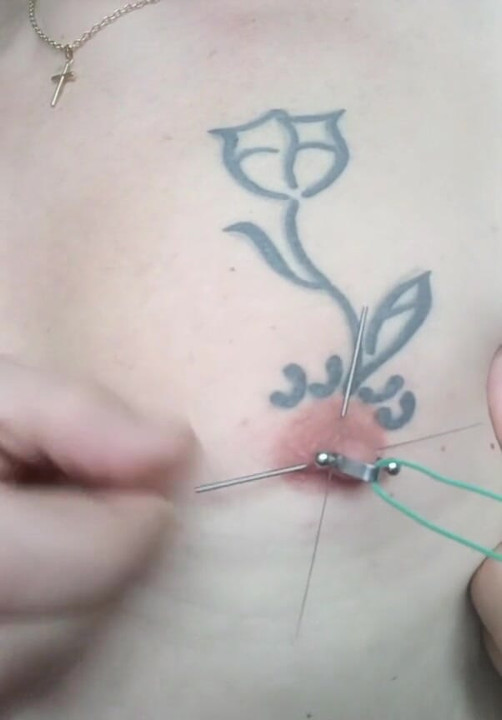 Two acupuncture needles passing through my nipple
