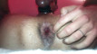 Pregled videozapisa