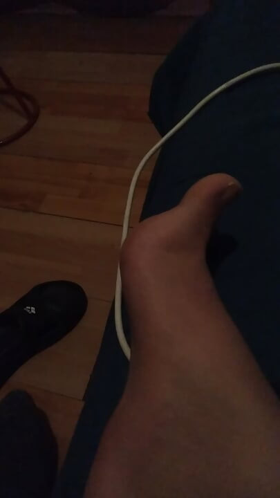 Moje noge za tebe