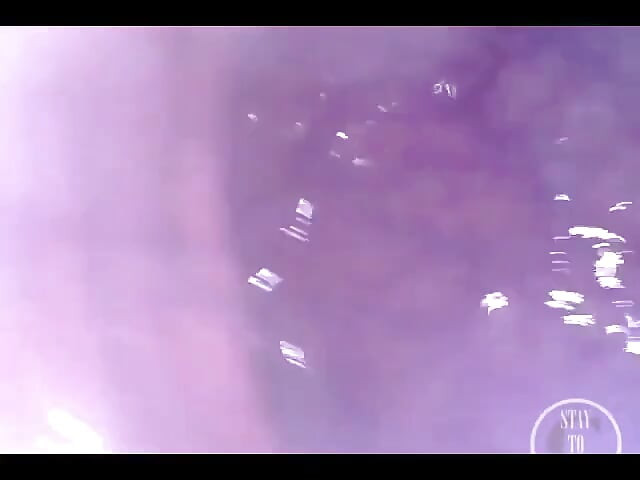 POV extrem tiefe anal-untersuchung!