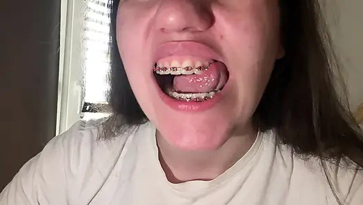 Licking Your Braces with Your Tongue