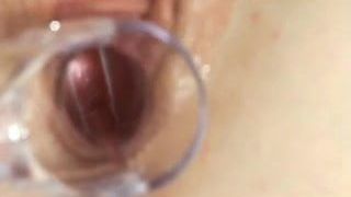 18yo Amateur's Vagina Too Tight for Speculum