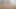 Just Shaving Post-op Orgasm Pussy Clit Masturbation Teasing Orgasm