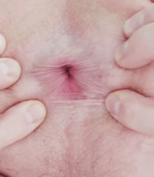Ânus sexy