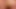 Anal Insertion of Ginger