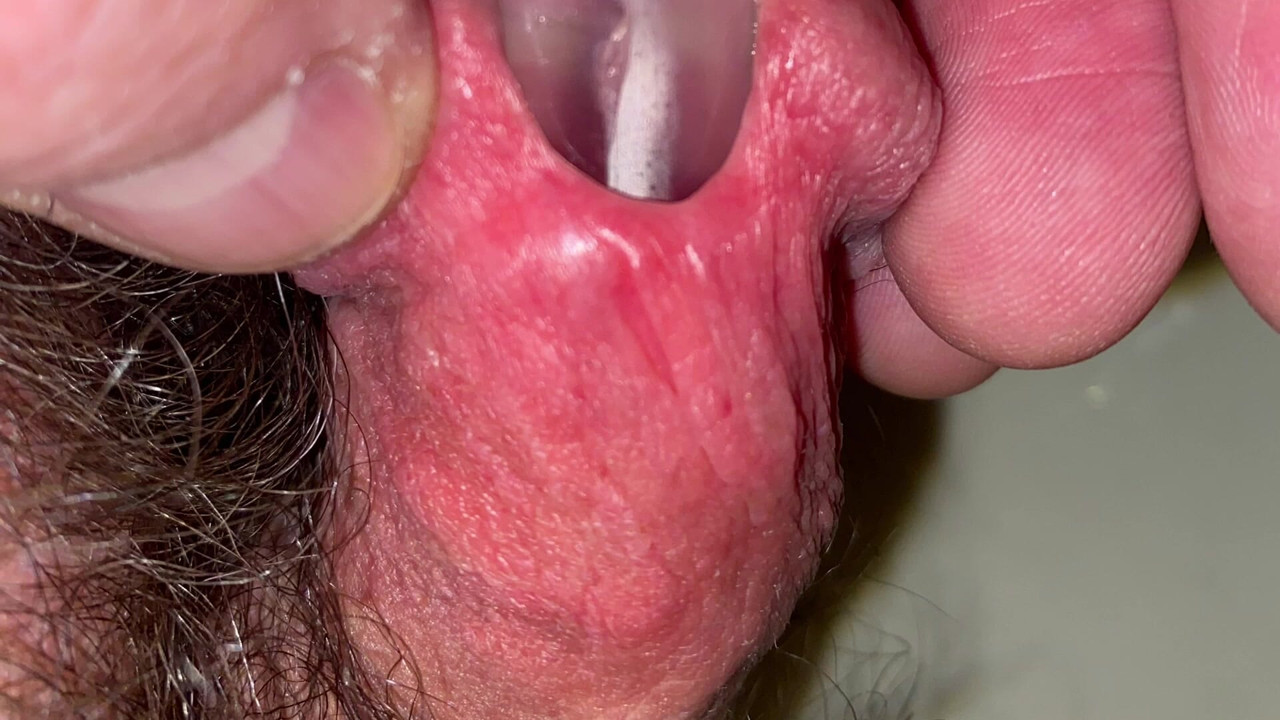 Âm thanh một ống tiêm mà không có một đầu sâu bên trong