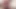 Doc Chocolate Vs Sinthia Bee