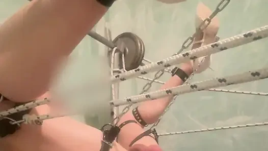 Banding no move anal