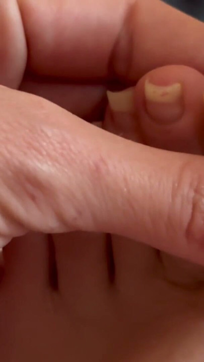 Long Toenails clipping closeup foot fetish | Clip 1