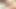 婦人科医の診察は急速に悪化しています!