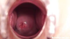 Joven enfermera abre su coño y muestra su cuello uterino a través del espéculo