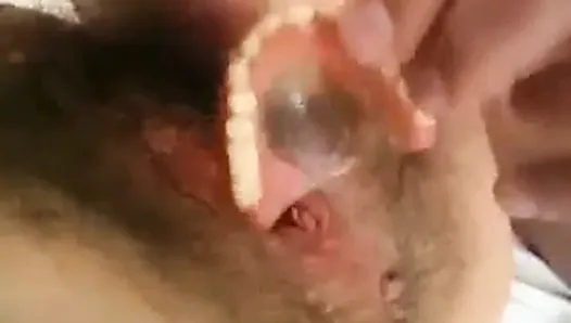 Hairy Pussy Mature Fucked And Played With Her Dentures