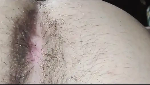 My Hairy Anus