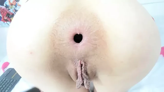 asshole