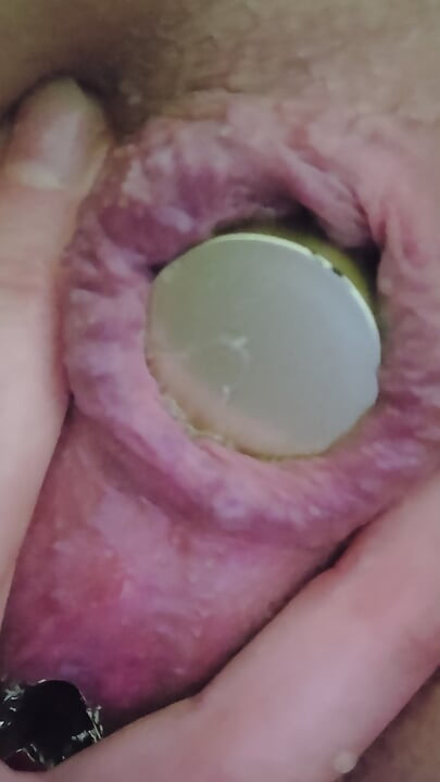 Close-up of a bottle inserted into the anus...