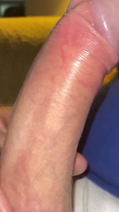 Easing the Foreskin back | Clip 1