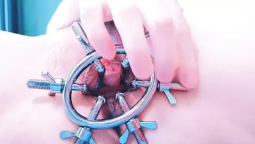 Speculum