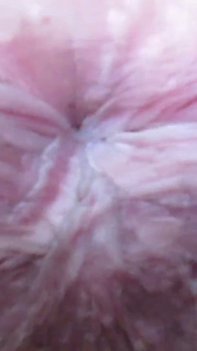 Asshole exteme closeup ass fetish anal | Clip 1