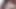 Anal gaping IR babe in stockings BBC ass and ATM fucked