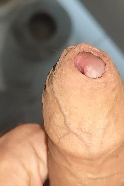 静脉爆炸的超现实特写.