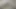 LizzyYum VR december 20 2023 Post Op Orgasm Pussy Masturbation Teasing