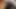 A 22-year-old boy is masturbating with his fist