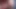 Oily Anus Gets Destroyed by 11-inch BBC Dildo