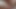 LizzyYum January 21 2024 #2 Post Op Orgasm Pussy Masturbation Teasing