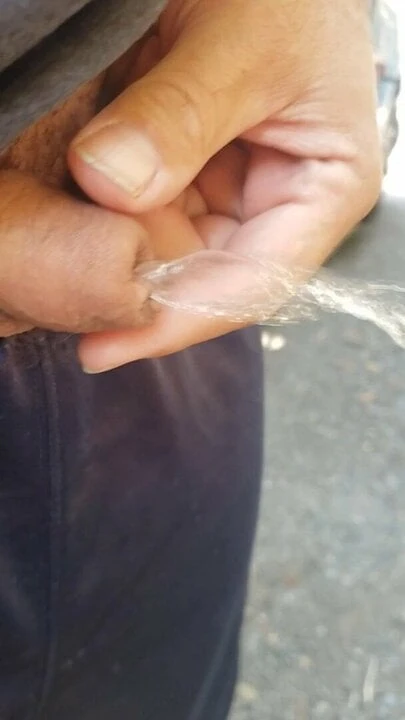 Micro pênis faz xixi em público