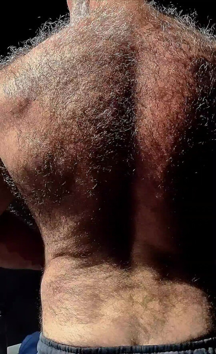 my HAIRY BACK